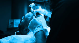 DHI-Haartransplantation-Methode